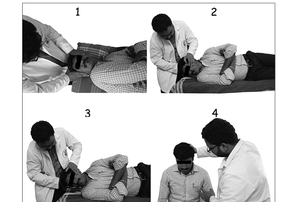 Outcome of Gans Repositioning Maneuver in Patients with Posterior Canal ...